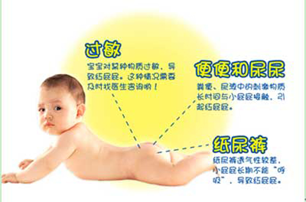 宝宝1.jpg