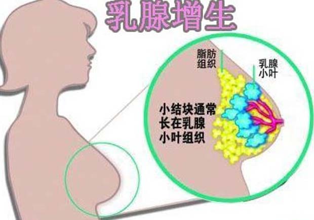 乳腺增生2.jpg