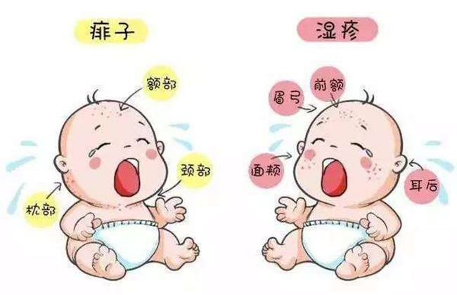 过敏2.jpg